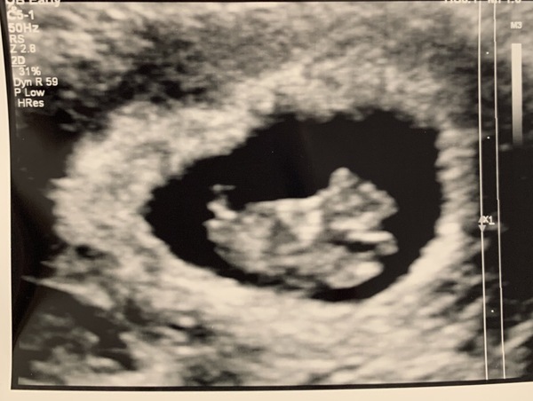 Due December 2019