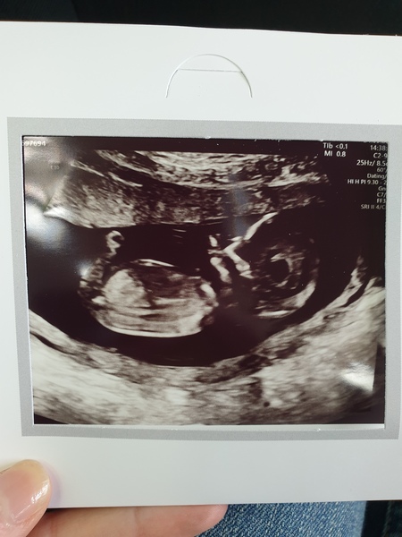 For fun - nub/skull theory