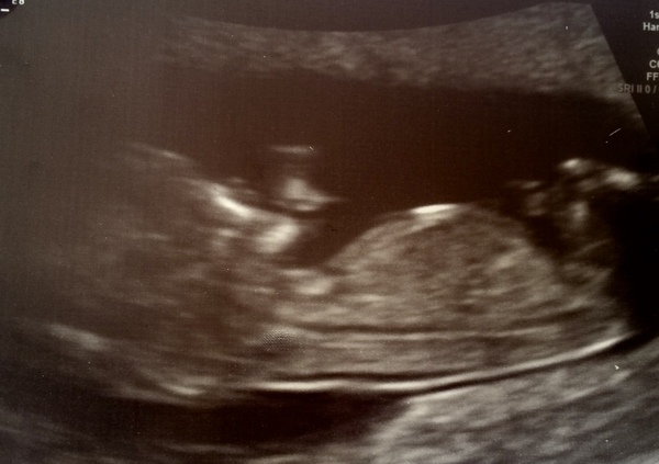 Due December 2019