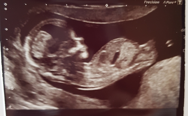 Feeling pregnant but no bfp yet