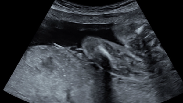 Girl or boy - I’m not convinced!