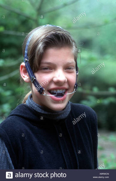 What is this type of brace called?