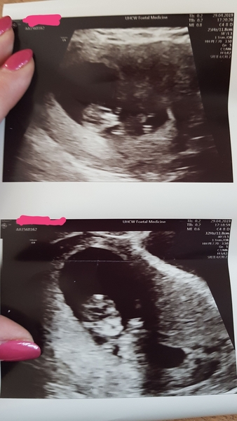 Due November 2019 Thread 4