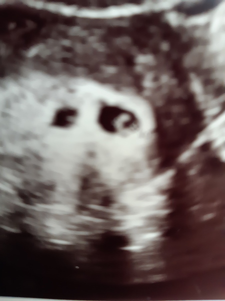 BFP - Due Jan 2020