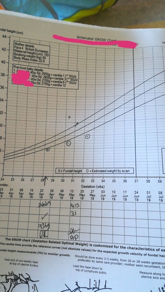 Inducing early due to small baby?