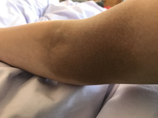 Please help me find an awful tattoo