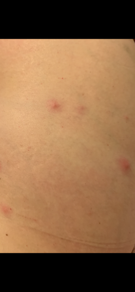 Help me- what are these spots