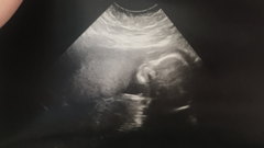 Boy or girl- any guesses??