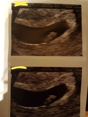 Boy or Girl 😍 ? Just for fun