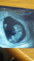 Is anyone else 9+ weeks?