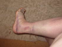 Anyone free to have a look at a picture of my foot?