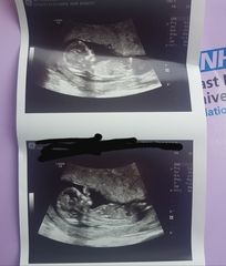 Nub theory, Gender guess