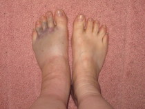 Anyone free to have a look at a picture of my foot?