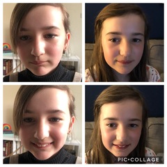 Twin Block Braces - Any Advice?