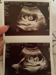 Boy or Girl 😍 ? Just for fun