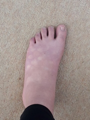Whats wrong with my feet?