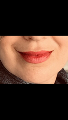 LIP FILLERS!!!!