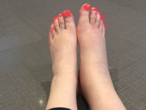 Anyone free to have a look at a picture of my foot?