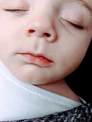 Baby coldsore?
