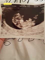 Boy or Girl 😍 ? Just for fun