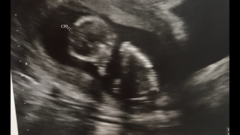 Boy or girl- any guesses??