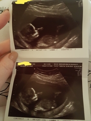 Boy or Girl 😍 ? Just for fun