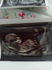 Gender guess