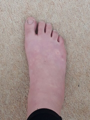 Whats wrong with my feet?