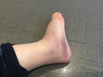 Anyone free to have a look at a picture of my foot?