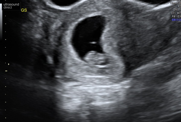 BFP - Anyone else due February 2020?