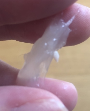 Mucus plug help **pic included - warning added by MNHQ**