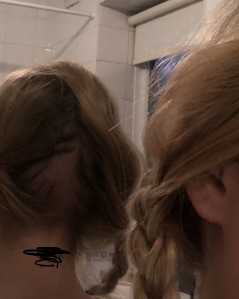 SHIT! I have an actual bald patch :(