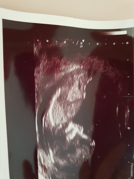 Boy or girl