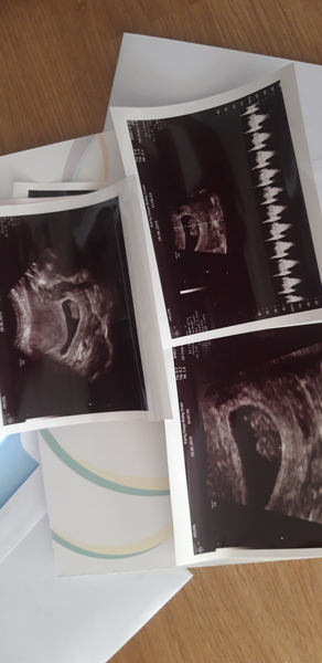 BFP - Anyone else due February 2020?