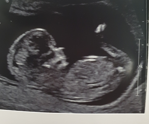 Christmas babies part 2