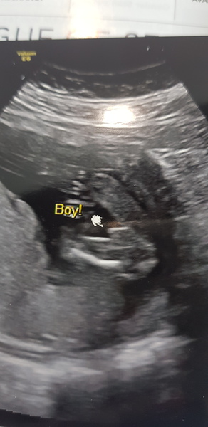 Due November 2019 Thread 4