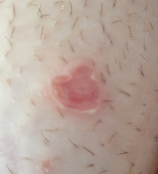 Any idea what this is?    TMI picture..