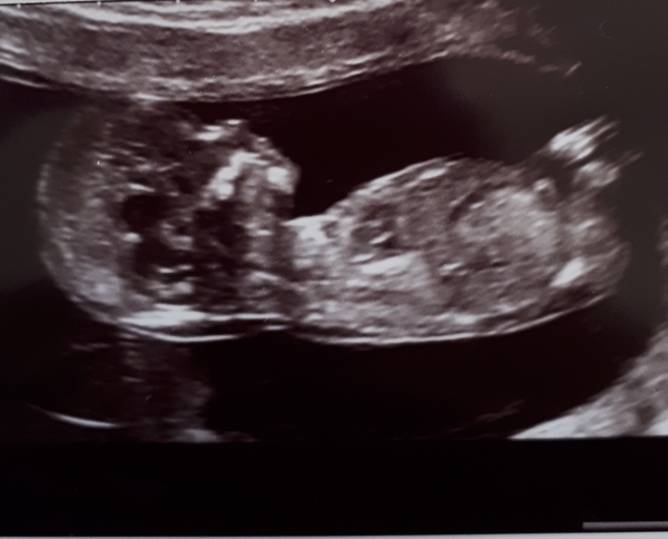 December 2019-Thread 2