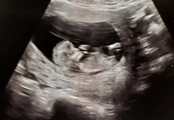 Boy/girl opinions please!!
