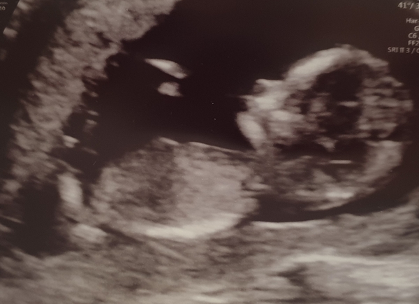 Christmas babies part 2