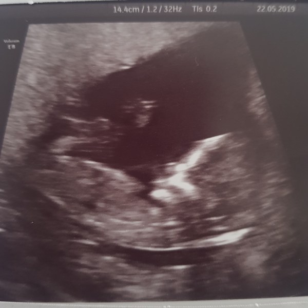 Boy or Girl?