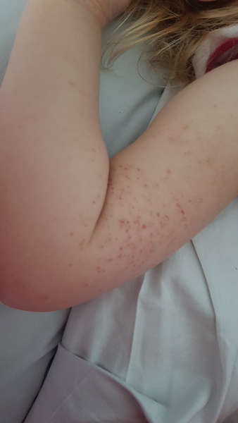 No reply.. spots on baby
