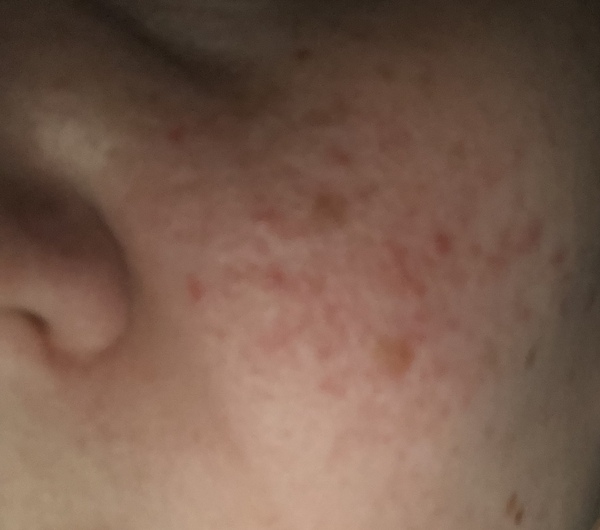 Skincare SOS