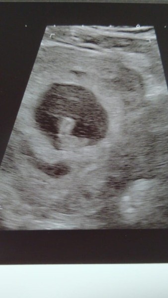 BFP - Anyone else due February 2020?