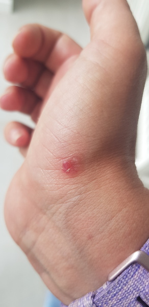 What is this on my hand?!