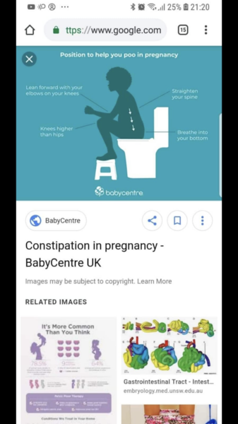 To ask if you have (or had) a prolapse after birth? I'm 25 and mortified