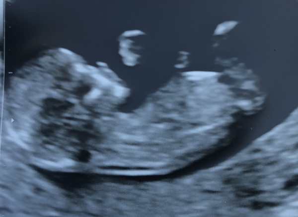 Just for fun! Gender Guess x