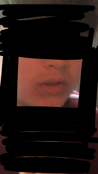 Ah fuck, DS has given himself a massive lovebite on his face