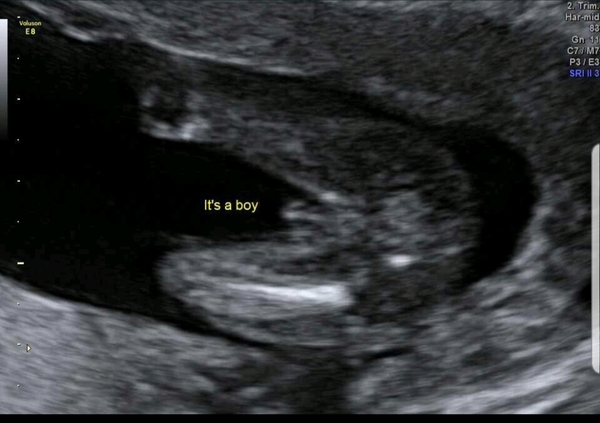 Gender scans??