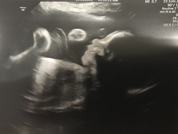 September 2019 #8 - The 3rd Trimester Begins